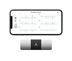 AliveCor KardiaMobile 6-Lead Personal EKG Monitor