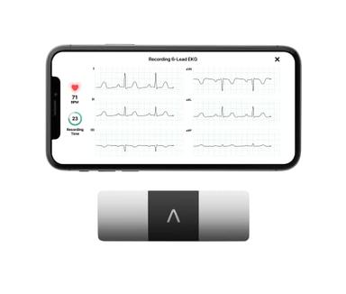 heart monitor