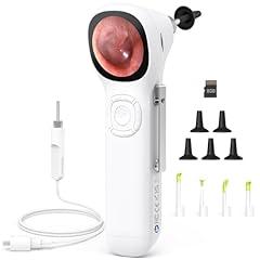 ScopeAround Digital Otoscope with IPS Screen