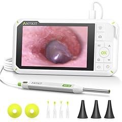 Anykit Digital Otoscope with Screen