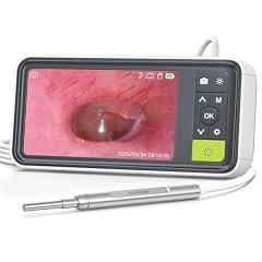 AnyScope 1080P Digital Otoscope with Screen