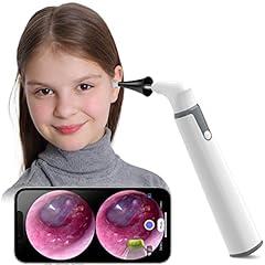 ScopeAround Wireless Otoscope Ear Camera