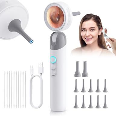 Digital otoscopes