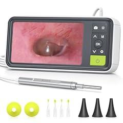 Anykit Digital Otoscope with Screen