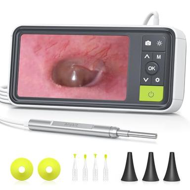 Digital otoscopes