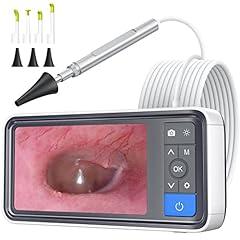 ScopeAround Otoscope Ear Camera with Screen