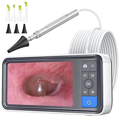 Digital otoscopes