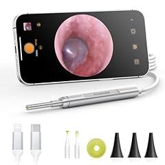 AnyScope Digital Otoscope for Smartphones