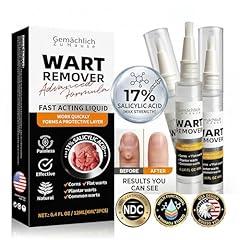 Maximum Strength Salicylic Acid Wart Remover