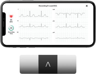 heart monitor
