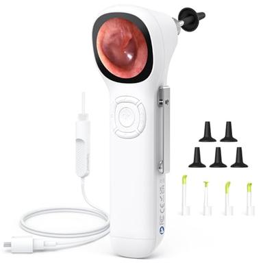 Digital otoscopes