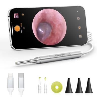 Digital otoscopes