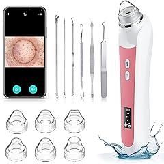 Ottleba Blackhead Remover Vacuum with Camera